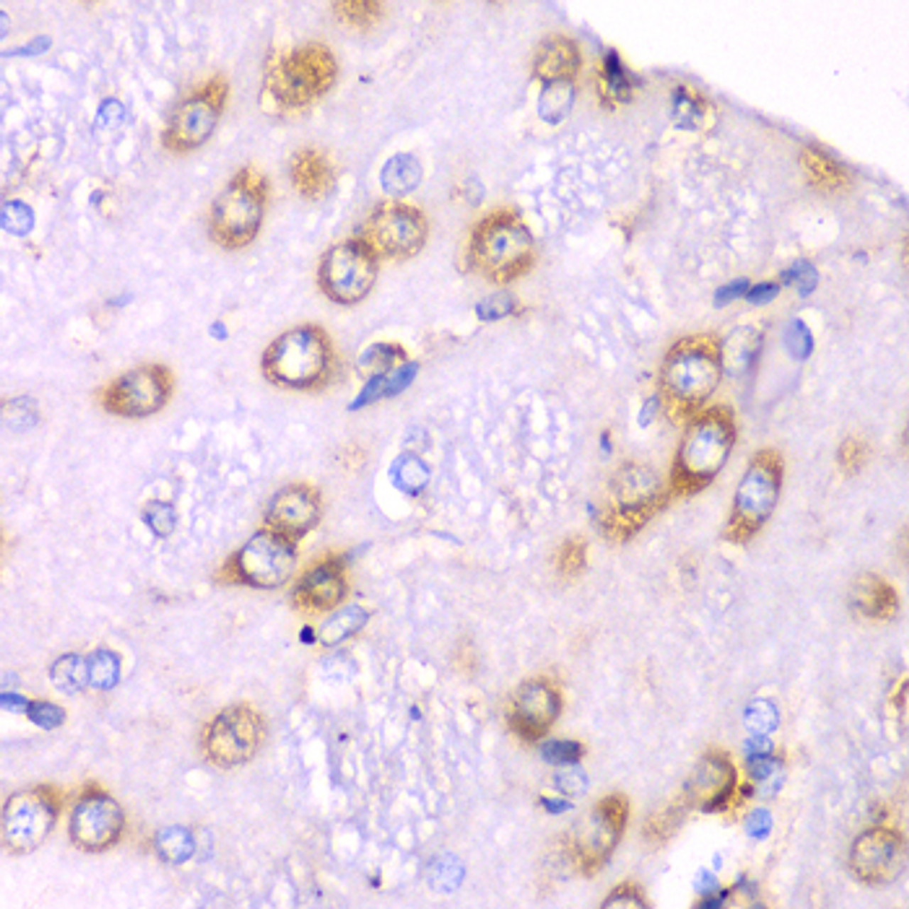 Immunohistochemistry of paraffin-embedded Rat brain using RPS3A Polyclonal Antibody at dilution of  1:100 (40x lens).