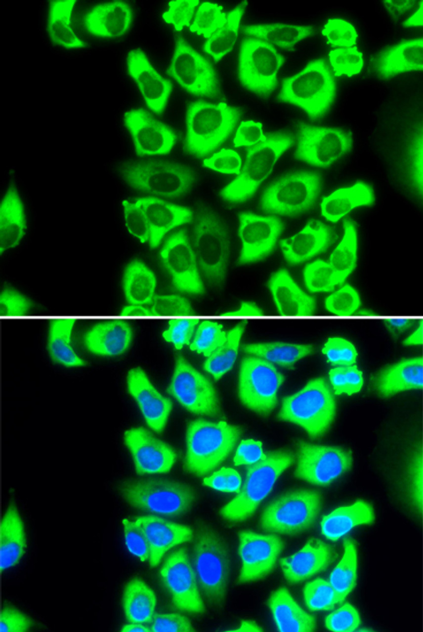 Immunofluorescence analysis of MCF-7 cells using RPS3A Polyclonal Antibody