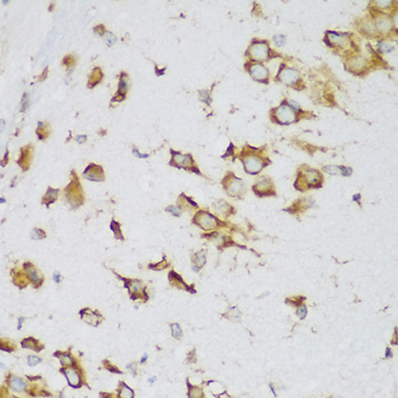 Immunohistochemistry of paraffin-embedded Mouse brain using MTDH Polyclonal Antibody at dilution of  1:200 (40x lens).