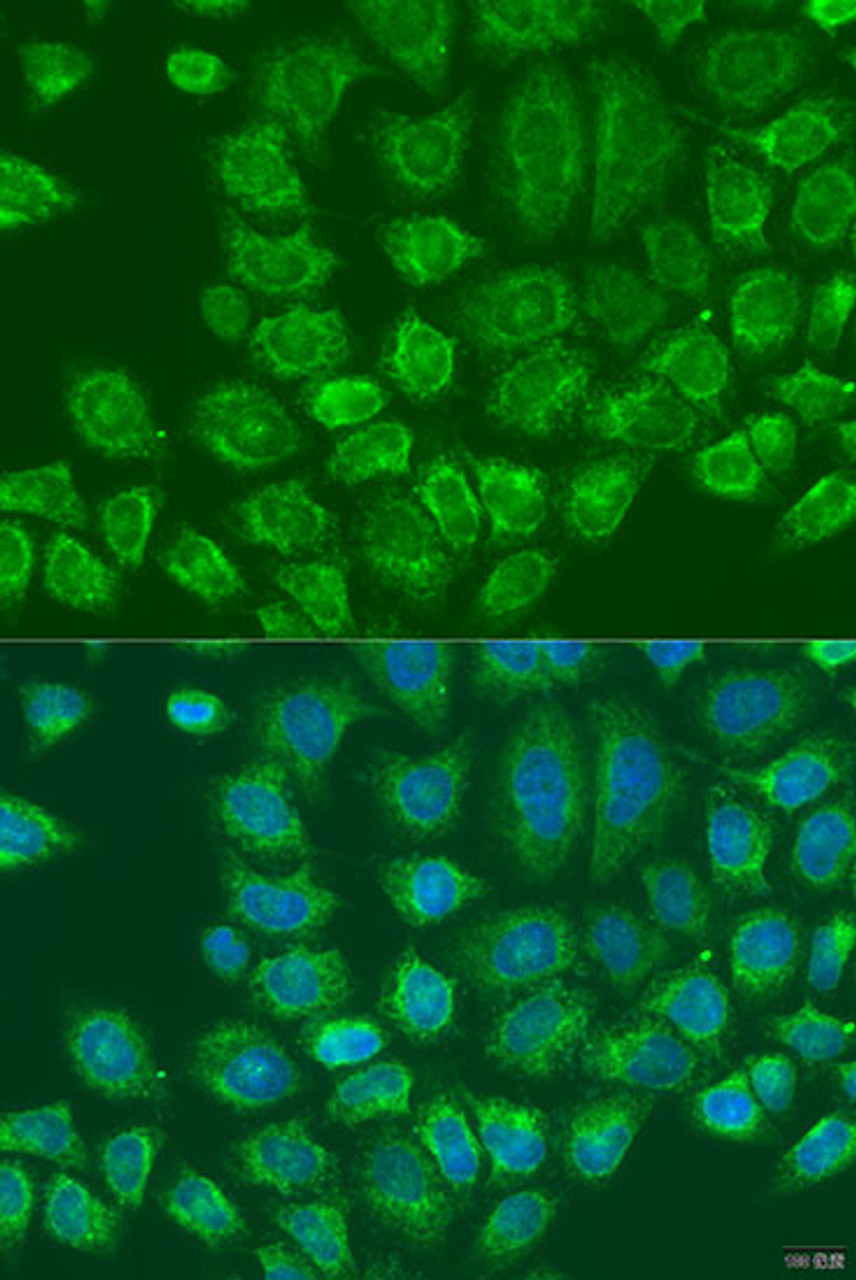 Immunofluorescence analysis of U2OS cells using MTDH Polyclonal Antibody at dilution of  1:100. Blue: DAPI for nuclear staining.