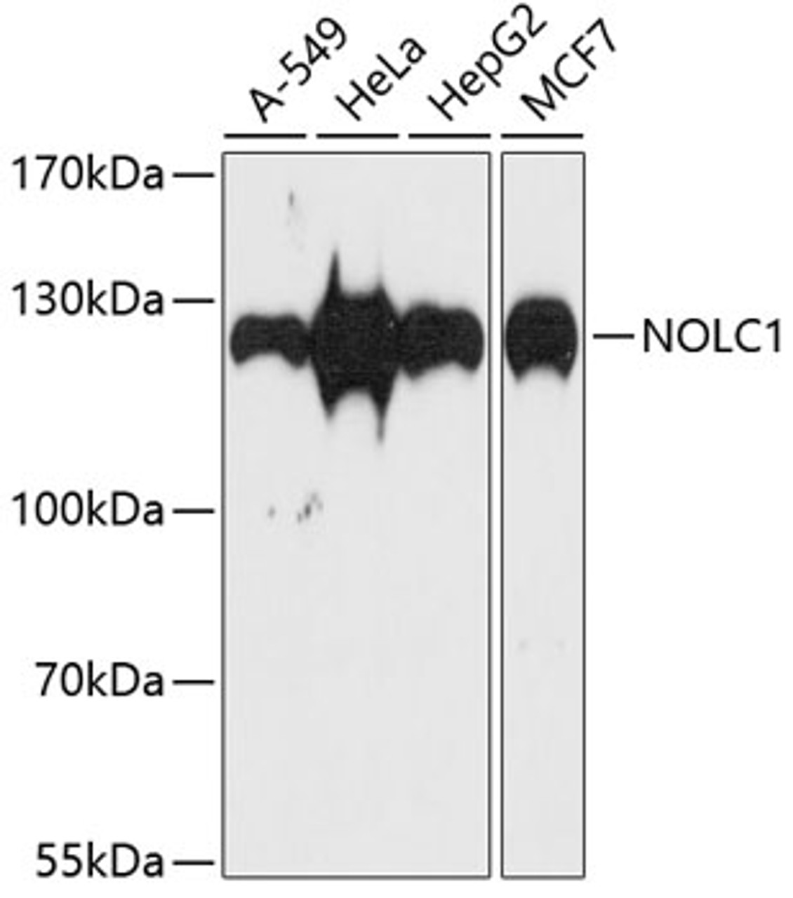 Western blot analysis of extracts of various cell lines using NOLC1 Polyclonal Antibody at dilution of 1:1000.