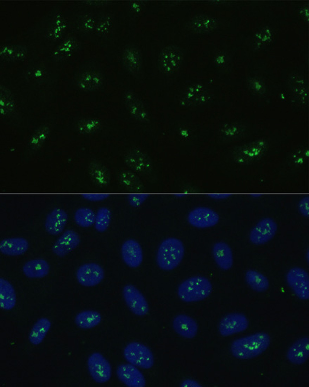 Immunofluorescence analysis of U-2 OS cells using NOLC1 Polyclonal Antibody at dilution of  1:100. Blue: DAPI for nuclear staining.