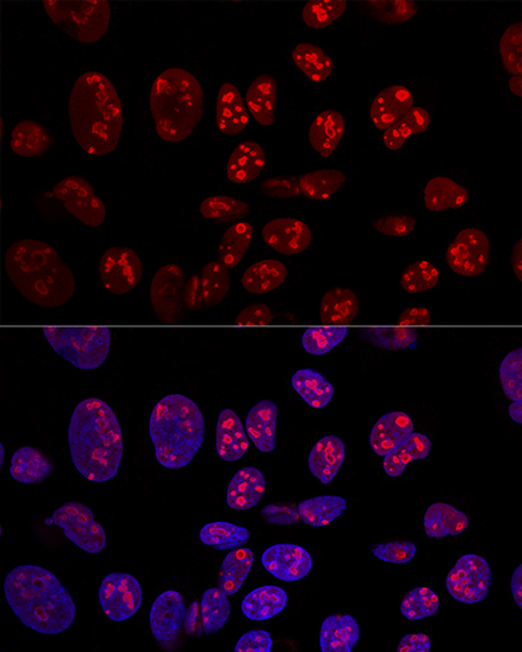 Confocal immunofluorescence analysis of U2OS cells using NCL Polyclonal Antibody at dilution of  1:100. Blue: DAPI for nuclear staining.