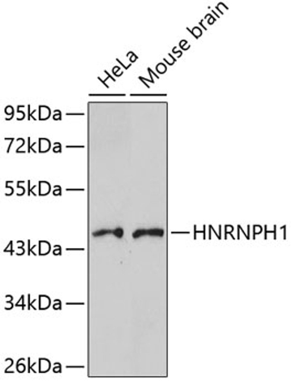 Western blot analysis of extracts of various cell lines using HNRNPH1 Polyclonal Antibody.