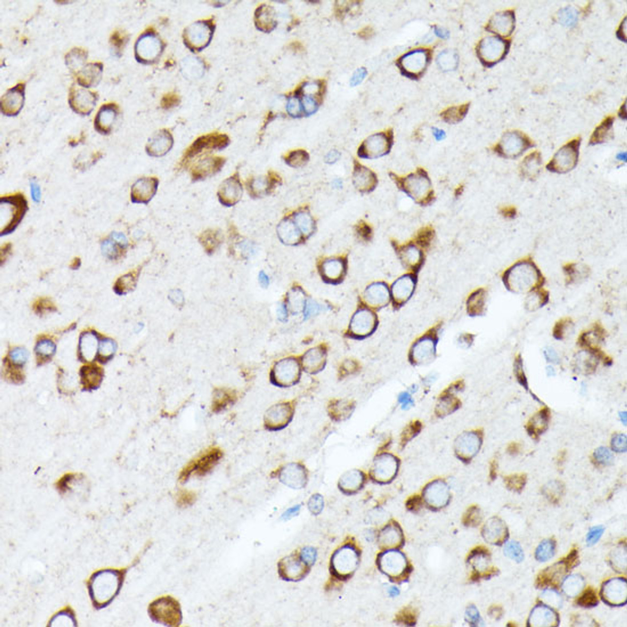 Immunohistochemistry of paraffin-embedded Rat brain using RPL7 Polyclonal Antibody at dilution of  1:100 (40x lens).