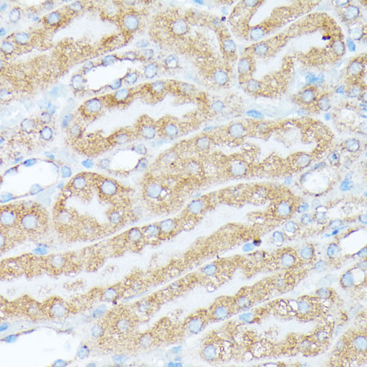 Immunohistochemistry of paraffin-embedded Mouse kidney using RPL7 Polyclonal Antibody at dilution of  1:100 (40x lens).