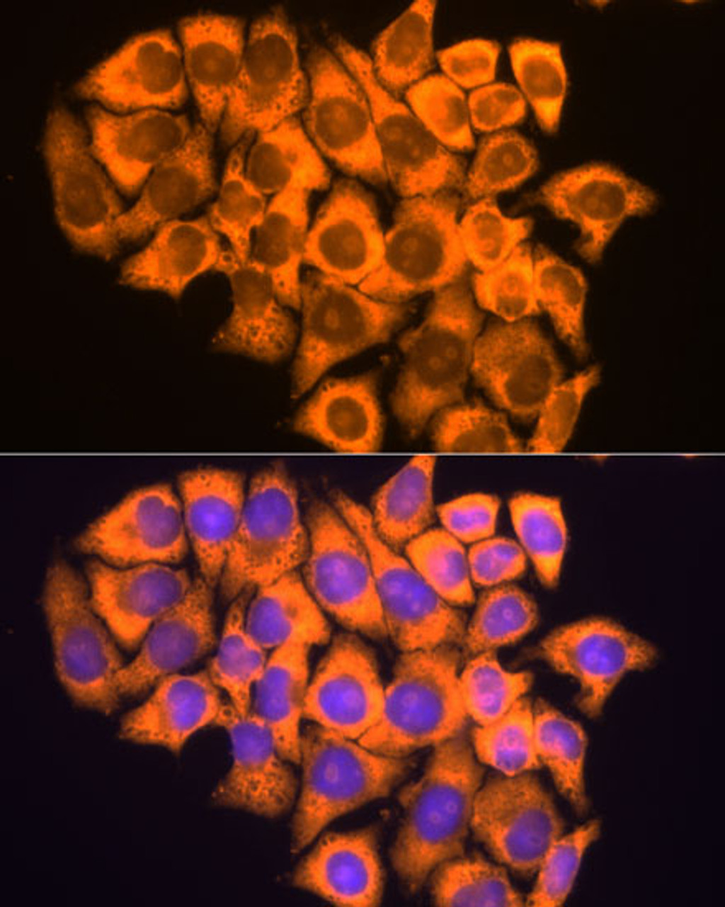 Immunofluorescence analysis of HeLa cells using RPL17 Polyclonal Antibody at dilution of  1:100. Blue: DAPI for nuclear staining.