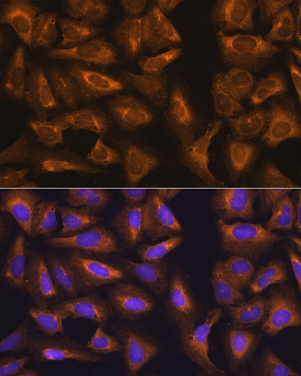 Immunofluorescence analysis of U-2 OS cells using RPL17 Polyclonal Antibody at dilution of  1:100. Blue: DAPI for nuclear staining.