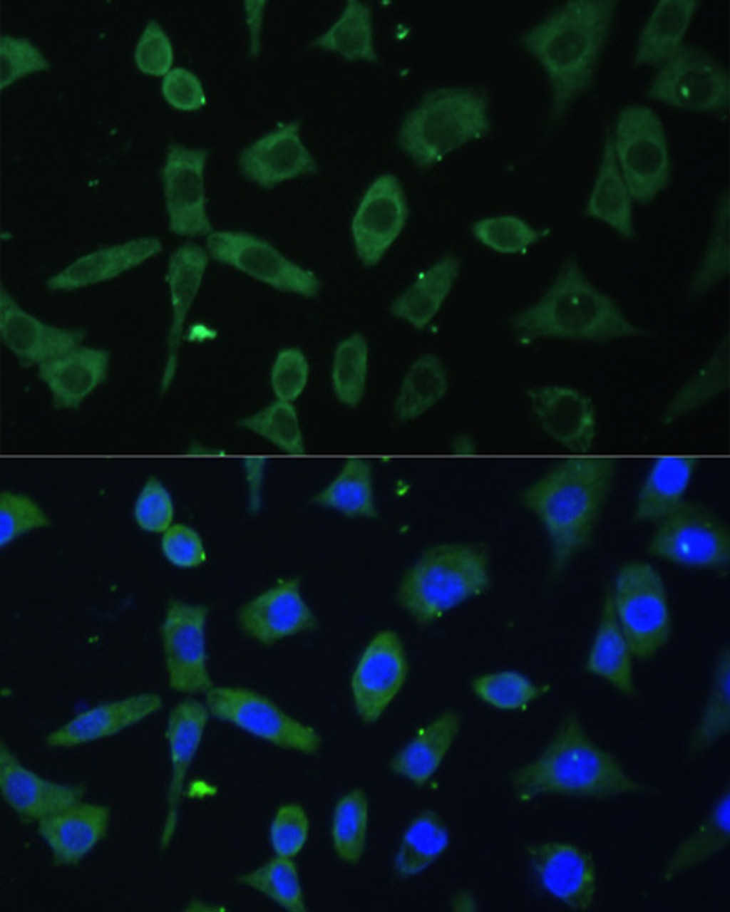 Immunofluorescence analysis of L-929 cells using EIF3D Polyclonal Antibody at dilution of  1:100. Blue: DAPI for nuclear staining.