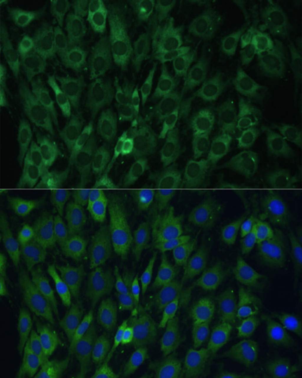 Immunofluorescence analysis of C6 cells using EIF3D Polyclonal Antibody at dilution of  1:100. Blue: DAPI for nuclear staining.