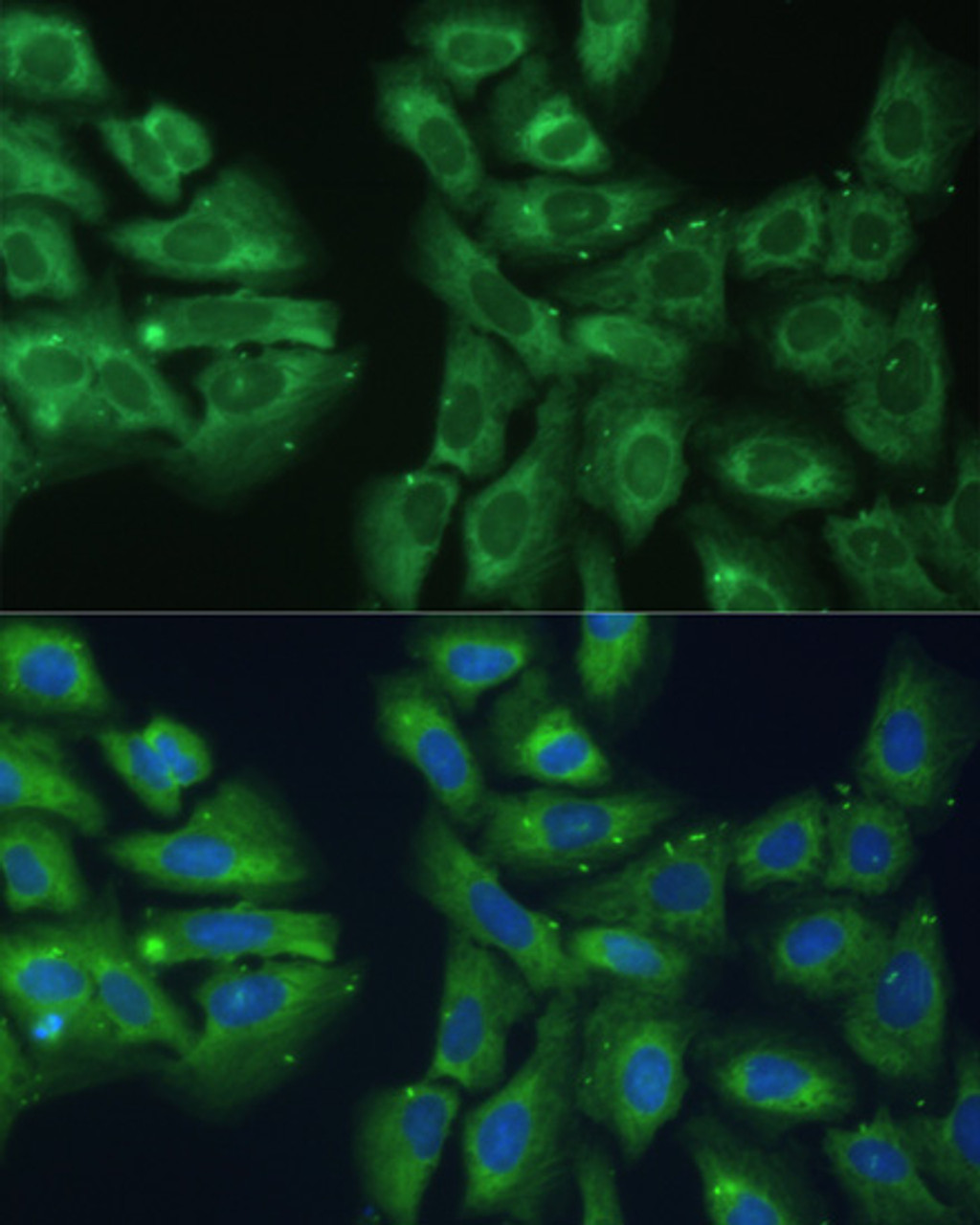 Immunofluorescence analysis of U-2 OS cells using EIF3D Polyclonal Antibody at dilution of  1:100. Blue: DAPI for nuclear staining.