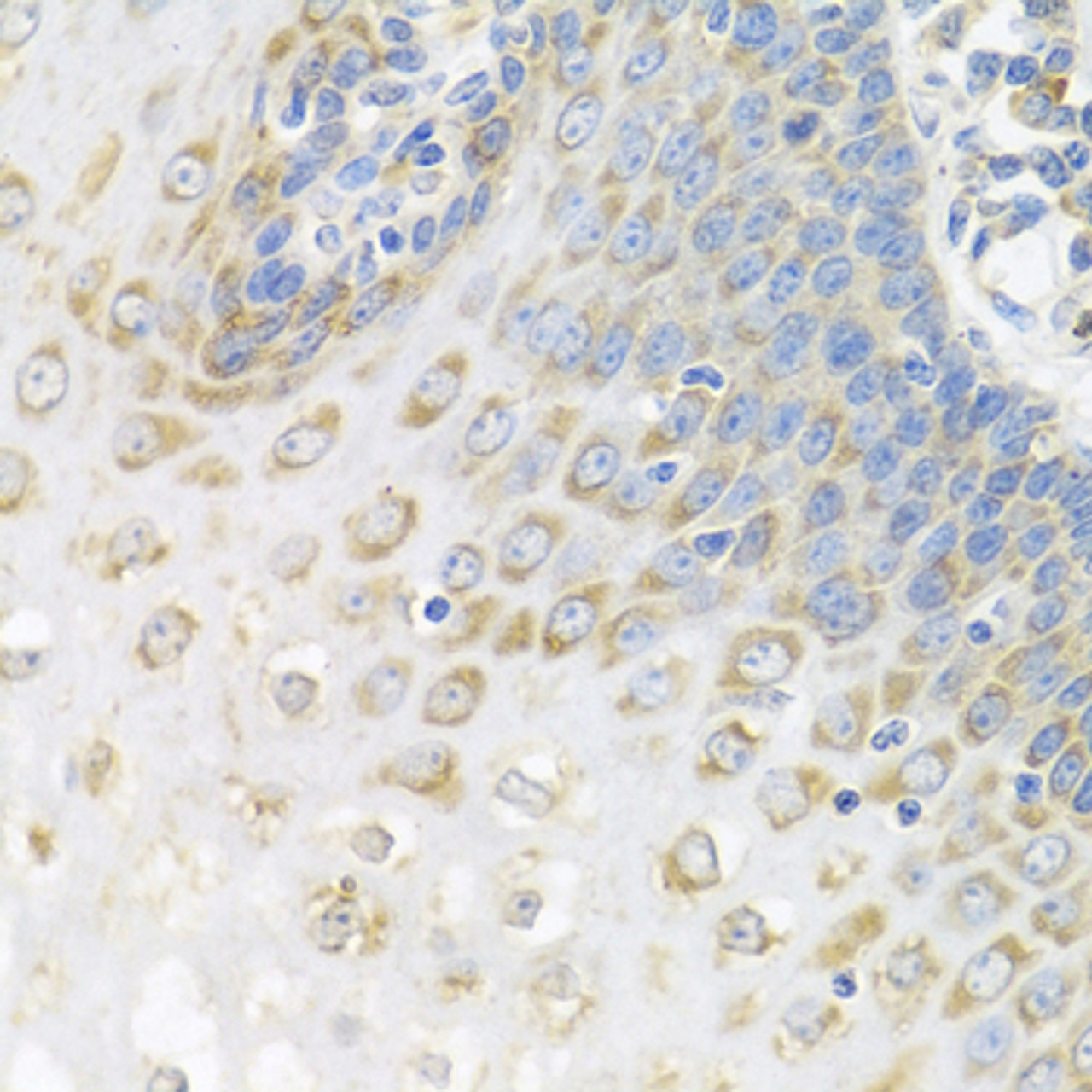 Immunohistochemistry of paraffin-embedded Human esophagus using Polyclonal AntibodyPC4 Polyclonal Antibody at dilution of  1:100 (40x lens).