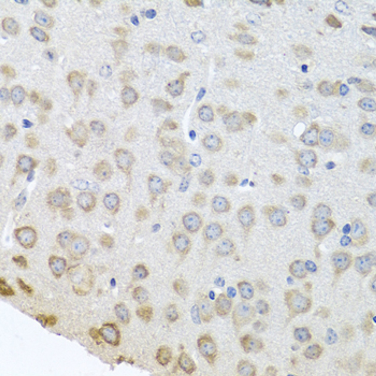 Immunohistochemistry of paraffin-embedded Mouse brain using Polyclonal AntibodyPC4 Polyclonal Antibody at dilution of  1:100 (40x lens).