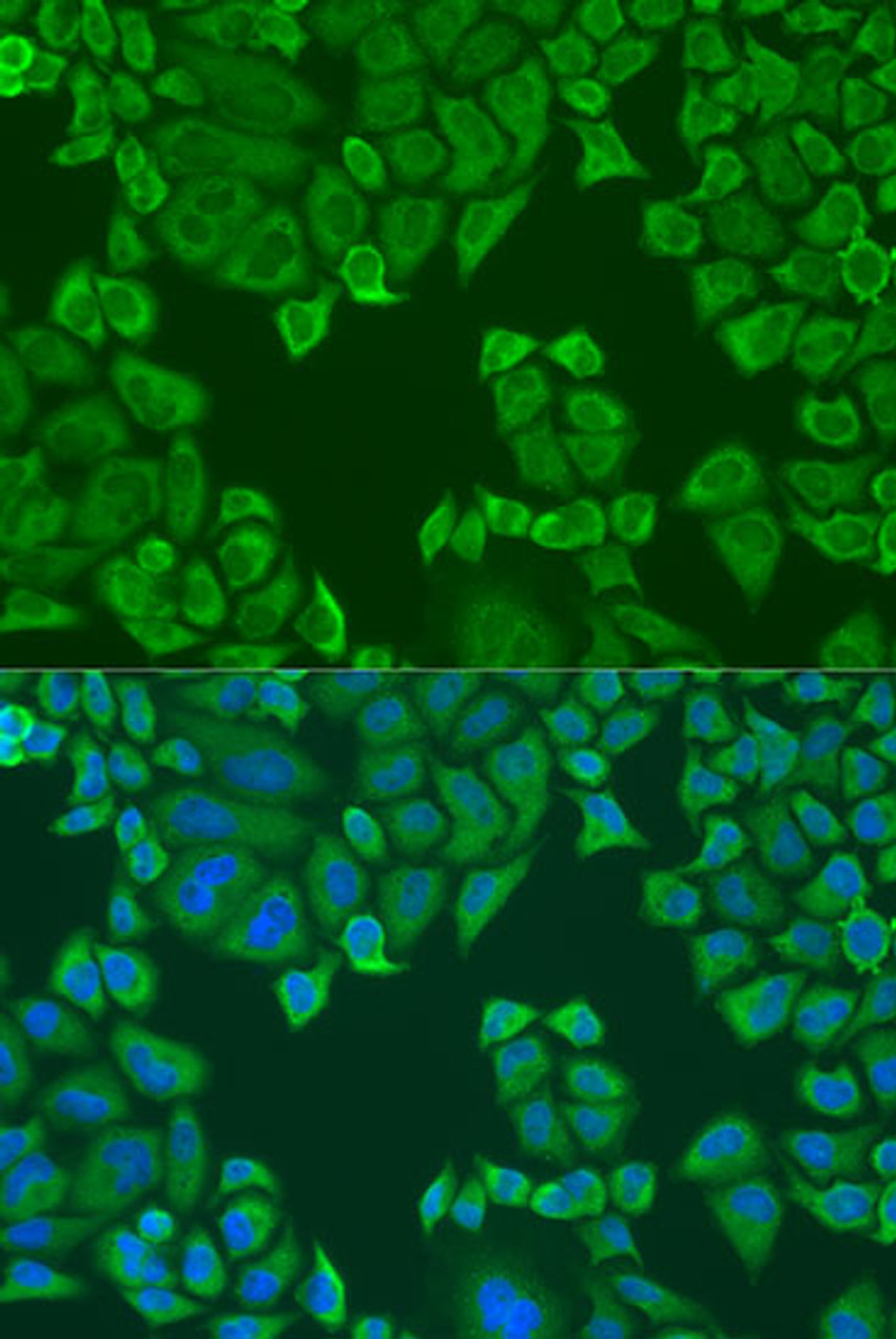 Immunofluorescence analysis of U2OS cells using Polyclonal AntibodyPC4 Polyclonal Antibody at dilution of  1:100. Blue: DAPI for nuclear staining.