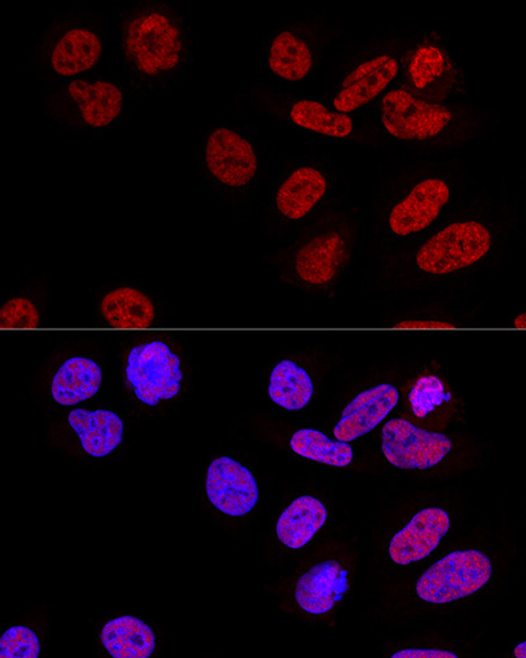 Confocal immunofluorescence analysis of U2OS cells using CPSF6 Polyclonal Antibody at dilution of  1:100. Blue: DAPI for nuclear staining.
