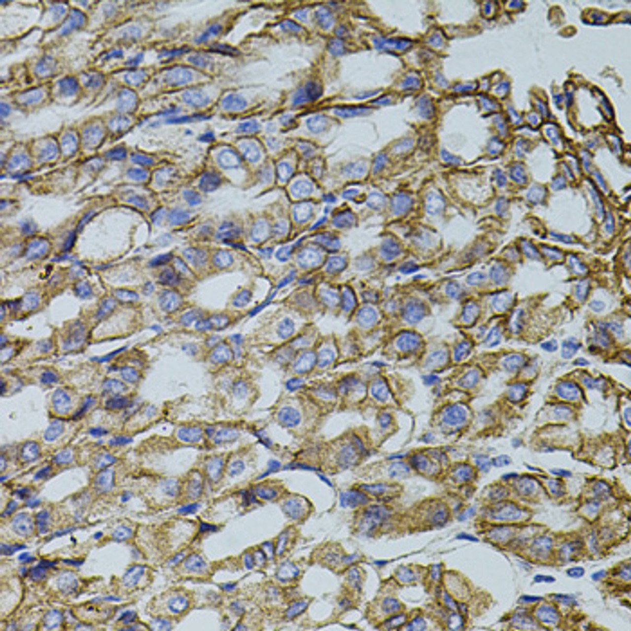 Immunohistochemistry of paraffin-embedded Mouse stomach using TRMT2A Polyclonal Antibody at dilution of  1:100 (40x lens).