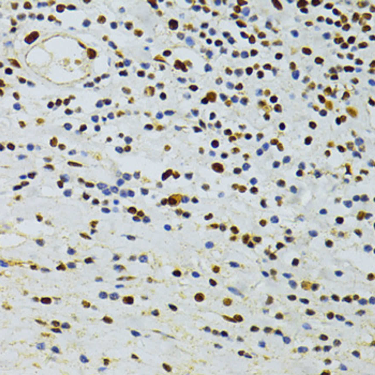 Immunohistochemistry of paraffin-embedded Human vermiform appendix using ALYREF Polyclonal Antibody at dilution of  1:100 (40x lens).