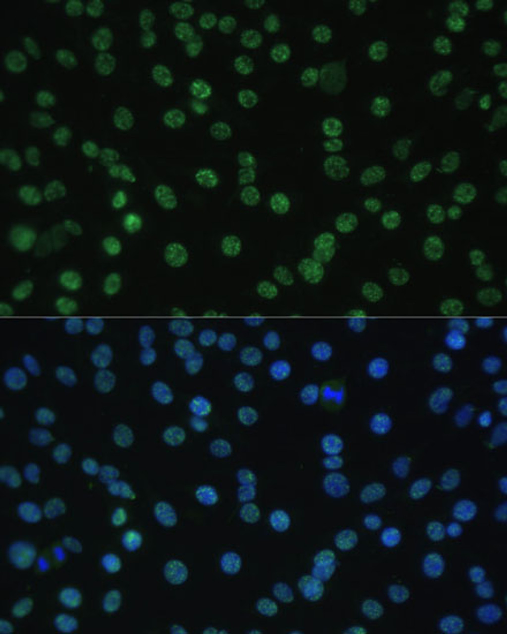 Immunofluorescence analysis of C6 cells using ALYREF Polyclonal Antibody at dilution of  1:100 (40x lens). Blue: DAPI for nuclear staining.