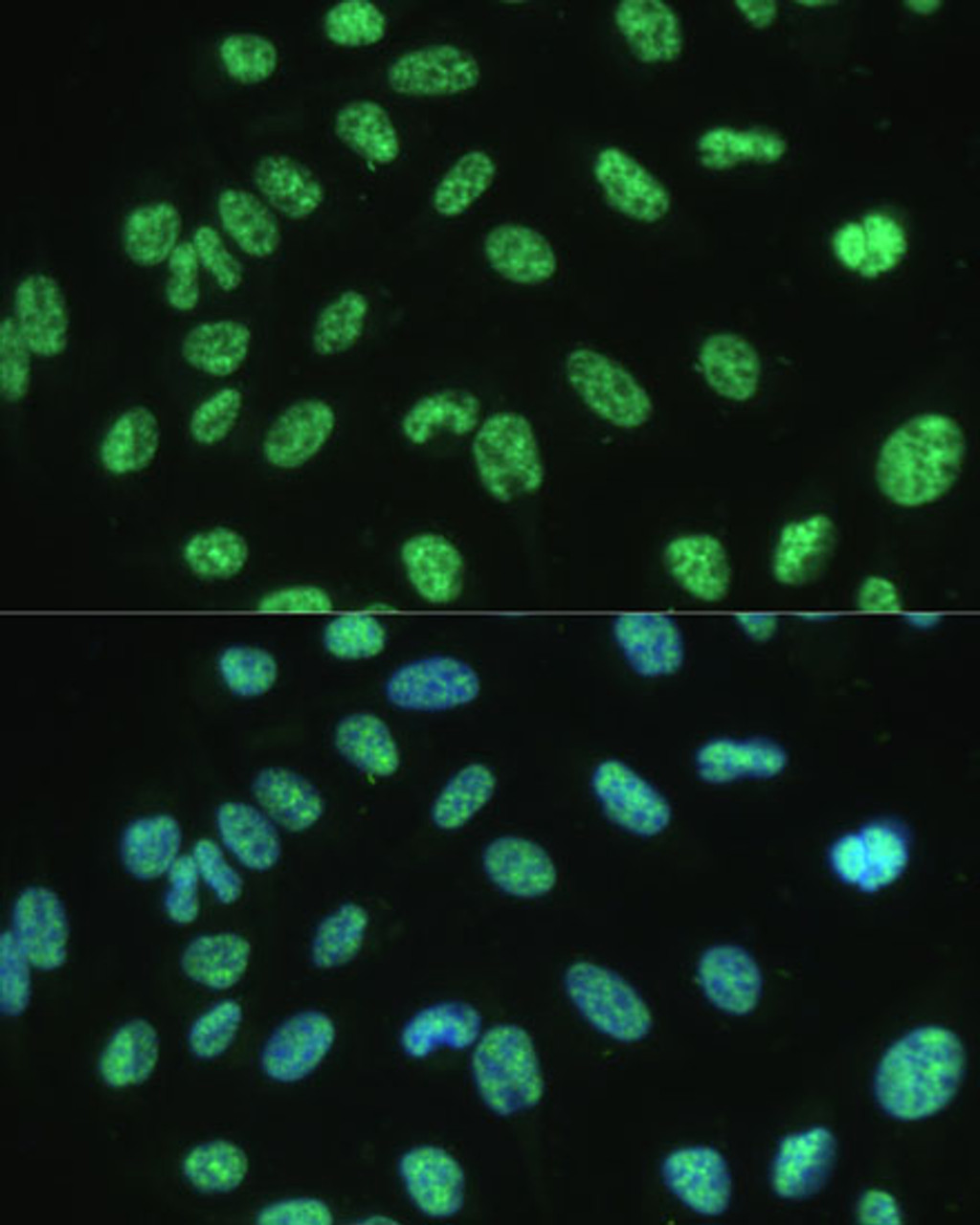Immunofluorescence analysis of U-2 OS cells using ALYREF Polyclonal Antibody at dilution of  1:100 (40x lens). Blue: DAPI for nuclear staining.