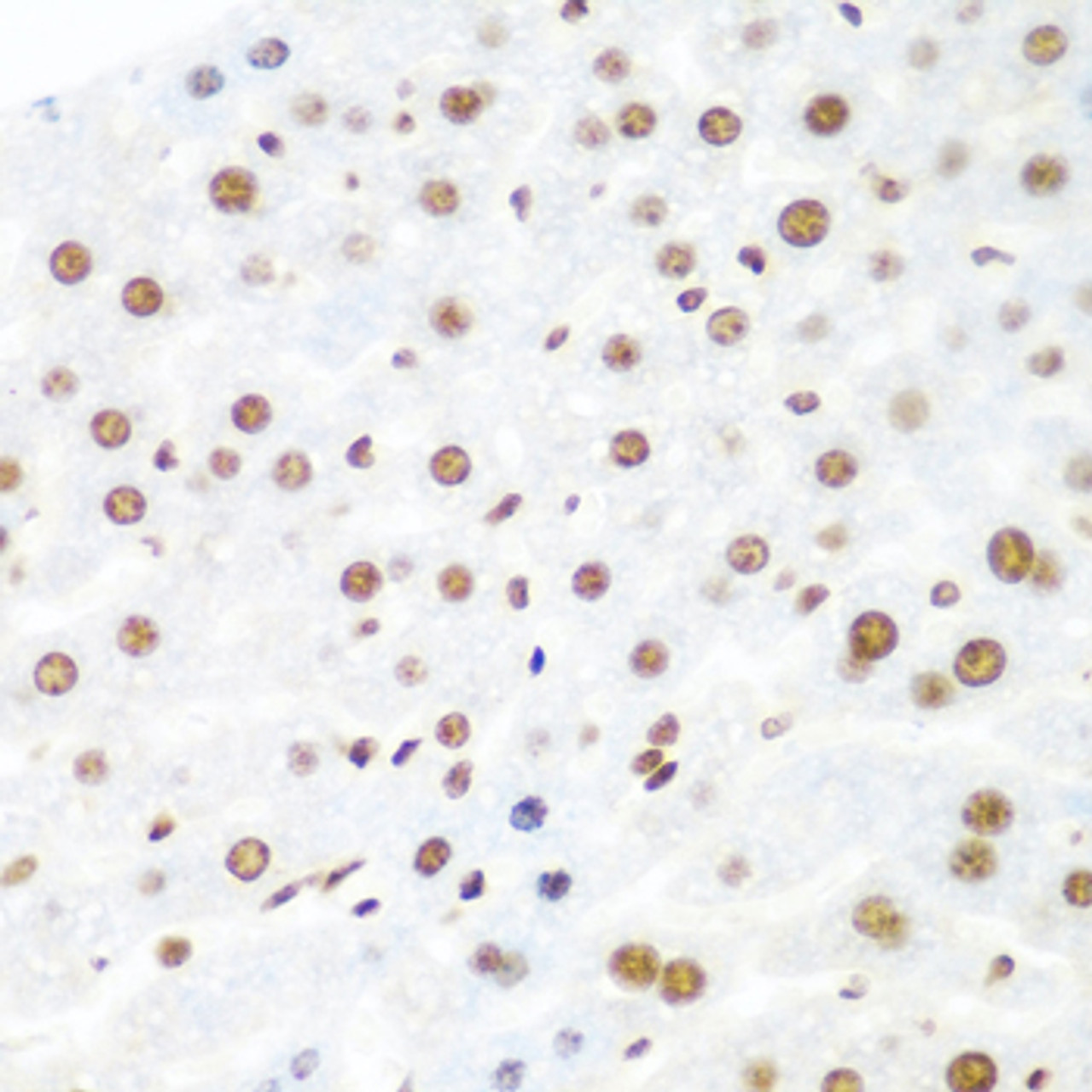 Immunohistochemistry of paraffin-embedded Mouse liver using Argonaute-2 Polyclonal Antibody at dilution of  1:100 (40x lens).