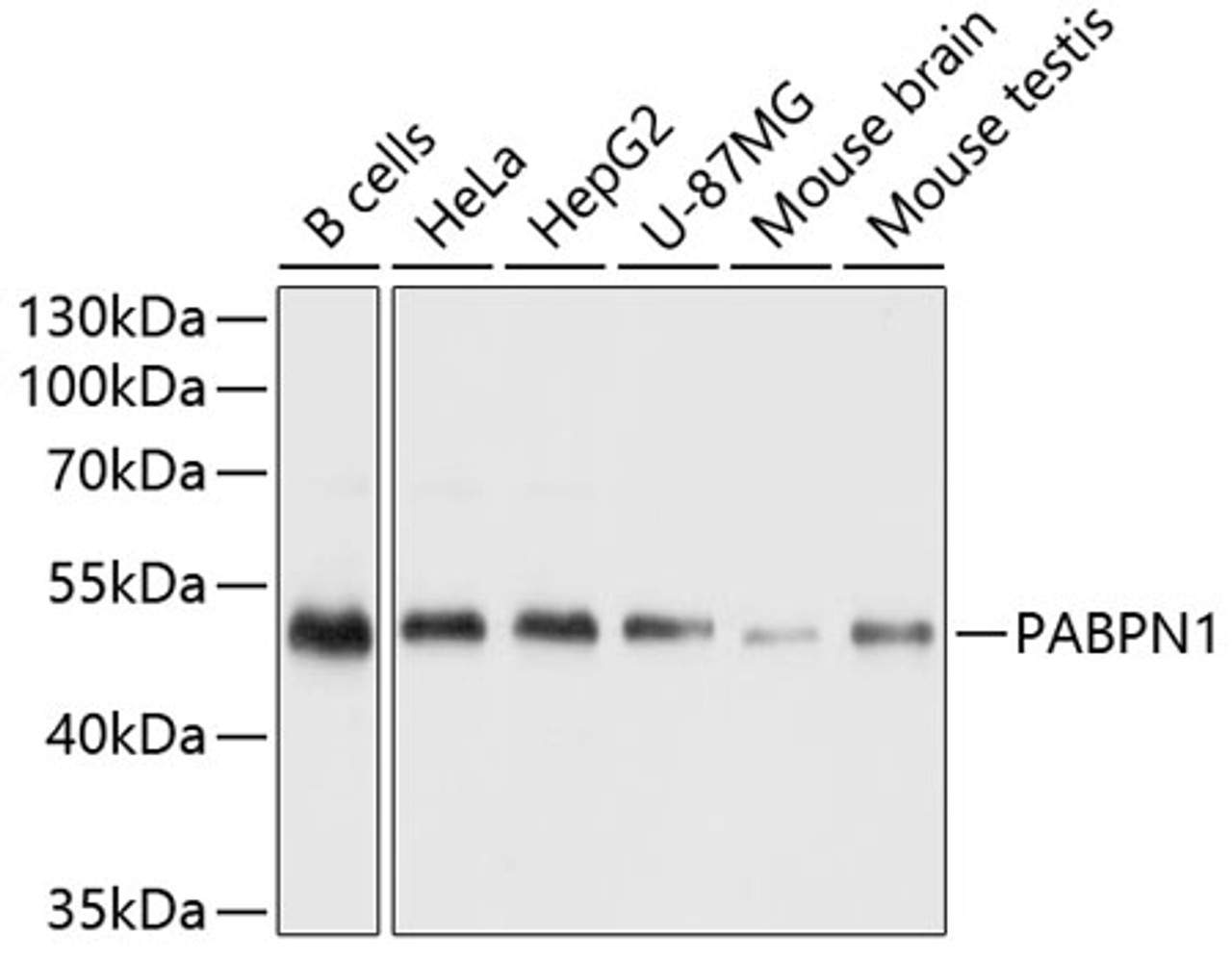 Western blot analysis of extracts of various cell lines using Polyclonal AntibodyPN1 Polyclonal Antibody at dilution of 1:1000.