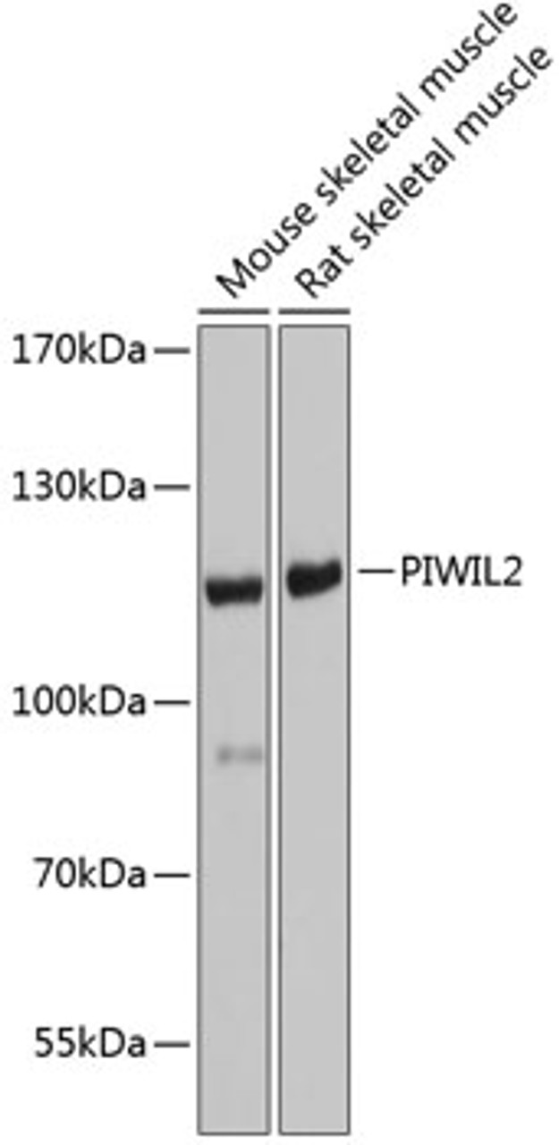 Western blot analysis of extracts of various cell lines using PIWIL2 Polyclonal Antibody at dilution of 1:1000.