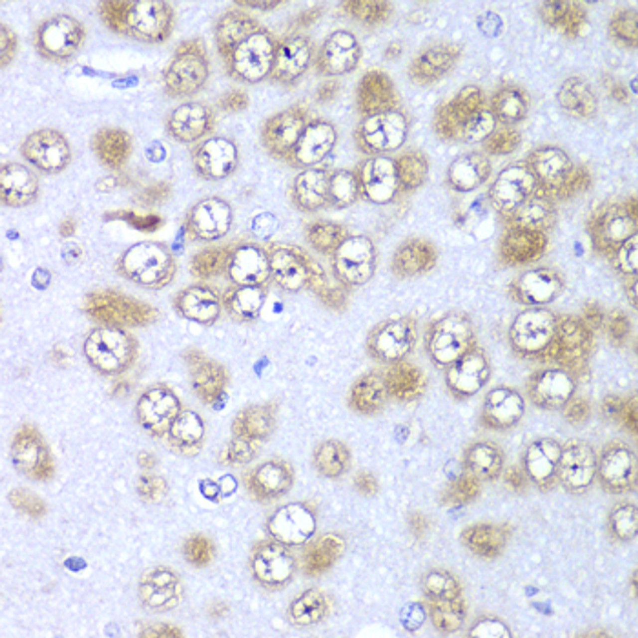 Immunohistochemistry of paraffin-embedded Rat brain using RPS10 Polyclonal Antibody at dilution of  1:100 (40x lens).