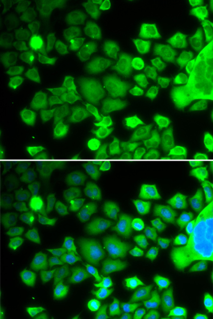 Immunofluorescence analysis of MCF-7 cells using RPS10 Polyclonal Antibody