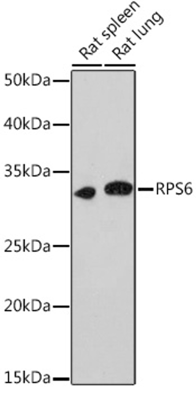 Western blot analysis of extracts of various cell lines using RPS6 Polyclonal Antibody at dilution of 1:1000.