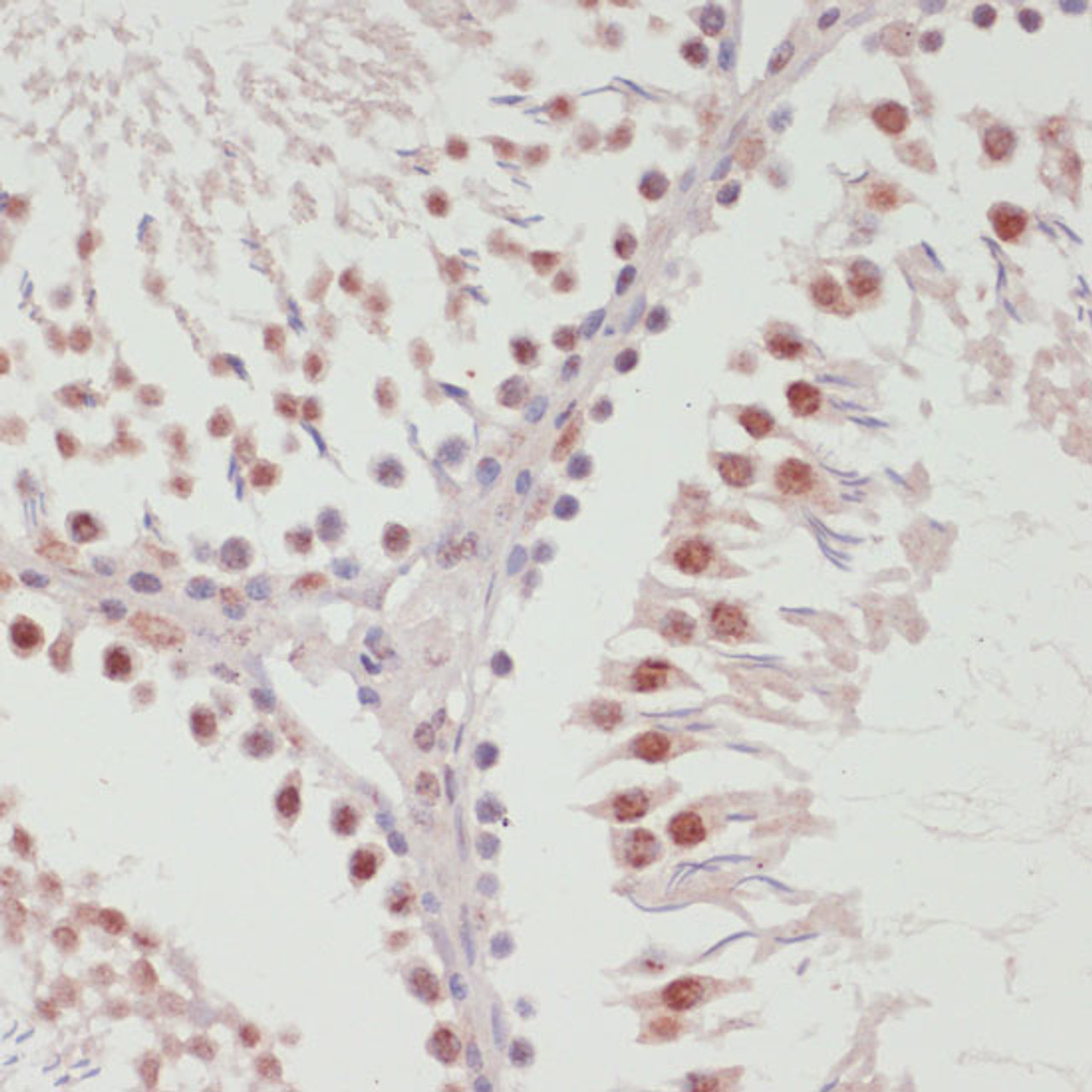 Immunohistochemistry of paraffin-embedded Rat testis using SNRNP70 Polyclonal Antibody at dilution of  1:100 (40x lens).