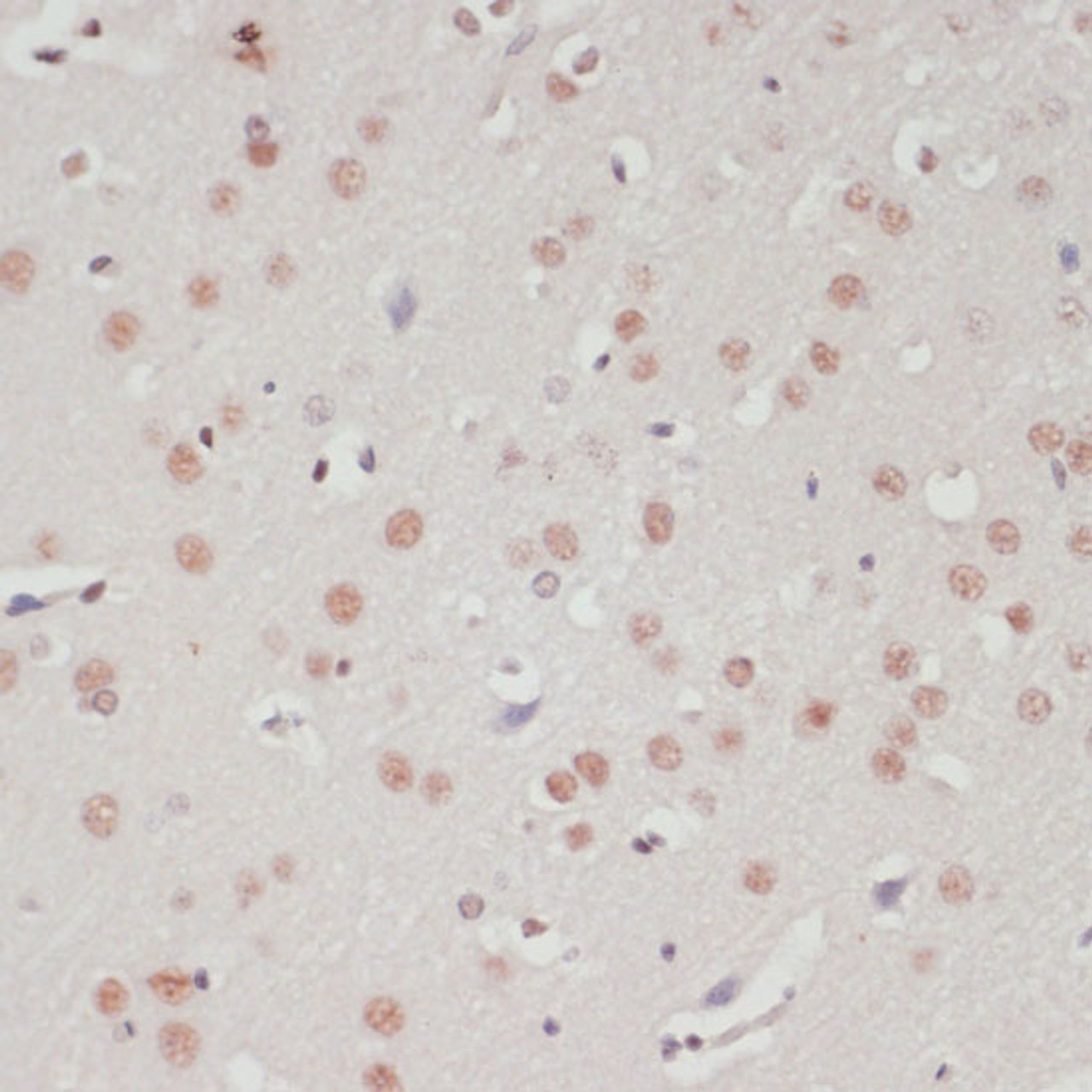 Immunohistochemistry of paraffin-embedded Rat brain using SNRNP70 Polyclonal Antibody at dilution of  1:100 (40x lens).