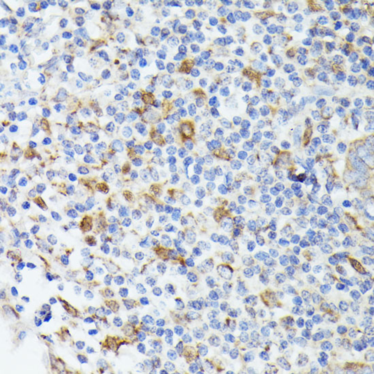 Immunohistochemistry of paraffin-embedded Human appendix using TIAL1 Polyclonal Antibody at dilution of  1:100 (40x lens).