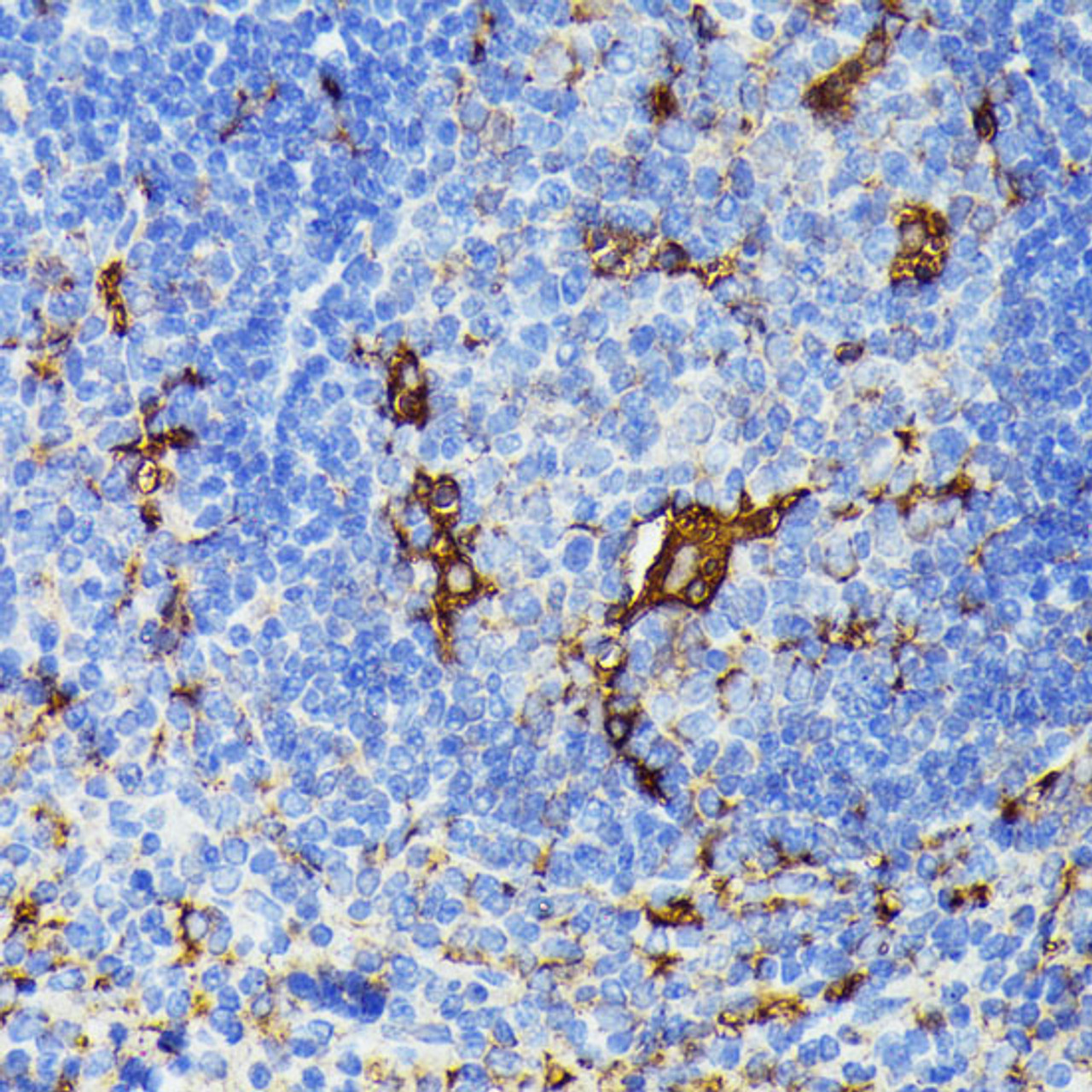 Immunohistochemistry of paraffin-embedded Mouse spleen using TIAL1 Polyclonal Antibody at dilution of  1:100 (40x lens).