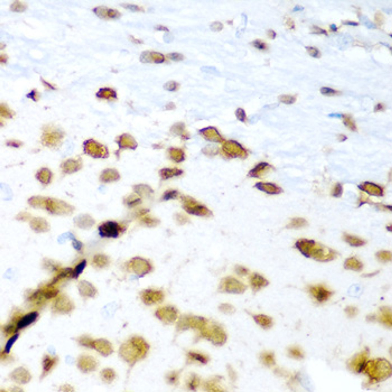 Immunohistochemistry of paraffin-embedded Mouse brain using ELAVL3 Polyclonal Antibody at dilution of  1:200 (40x lens).