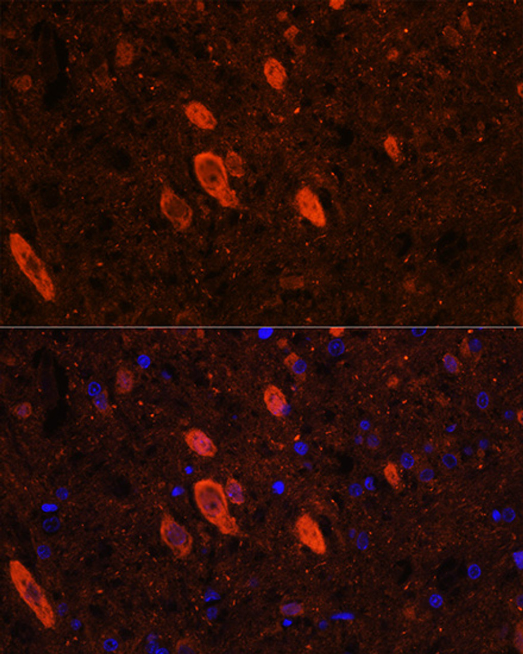 Immunofluorescence analysis of Rat brain using ELAVL3 Polyclonal Antibody at dilution of  1:100 (40x lens). Blue: DAPI for nuclear staining.