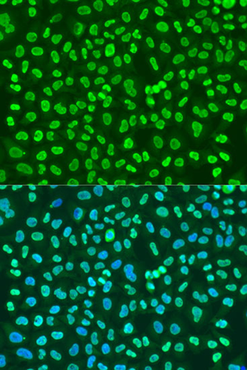 Immunofluorescence analysis of U2OS cells using PTBP1 Polyclonal Antibody at dilution of  1:100. Blue: DAPI for nuclear staining.