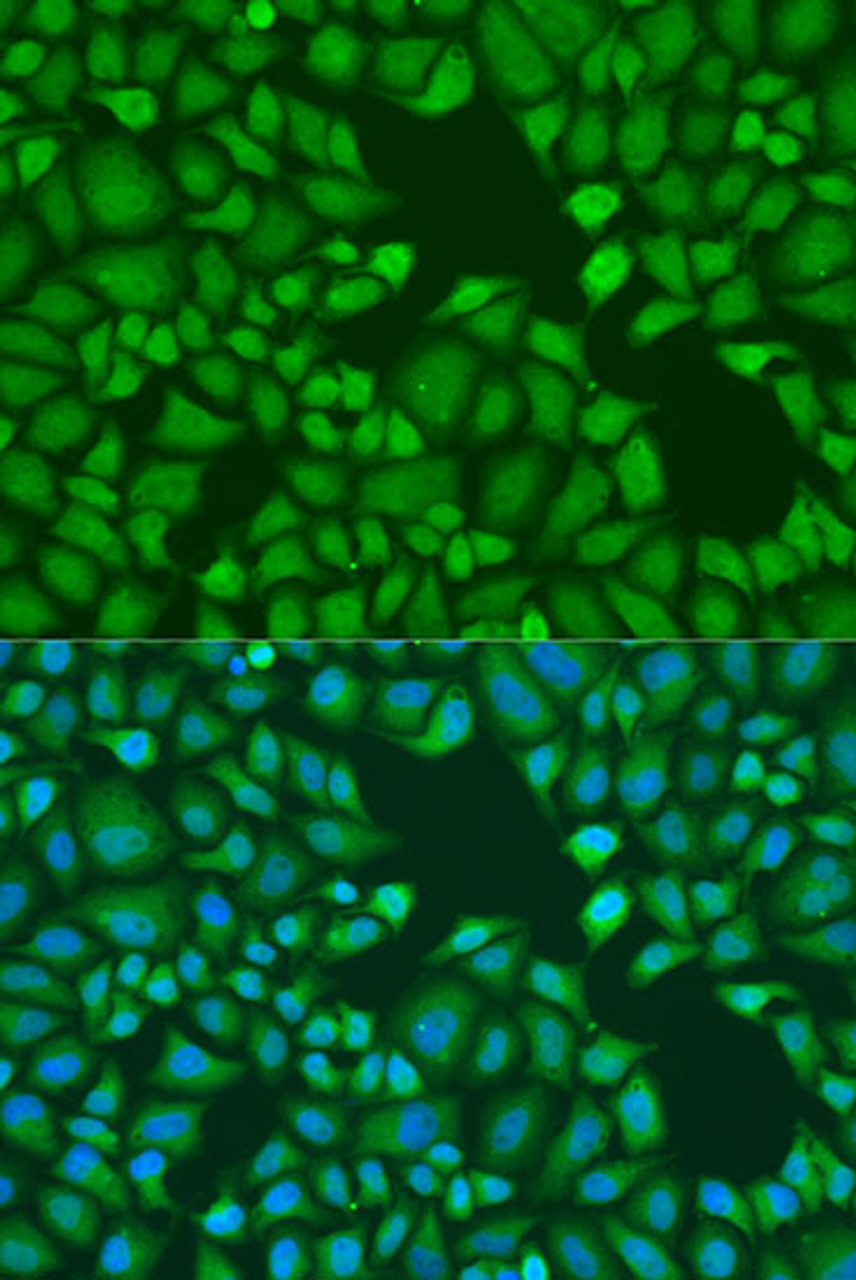 Immunofluorescence analysis of U2OS cells using TNRC6A Polyclonal Antibody at dilution of  1:100. Blue: DAPI for nuclear staining.