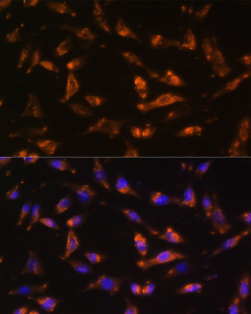 Immunofluorescence analysis of L929 cells using CSF2 Polyclonal Antibody at dilution of  1:100. Blue: DAPI for nuclear staining.