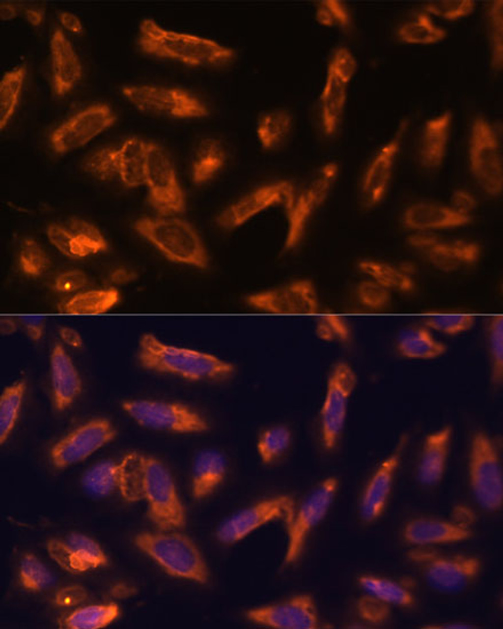 Immunofluorescence analysis of U-2 OS cells using CSF2 Polyclonal Antibody at dilution of  1:100. Blue: DAPI for nuclear staining.