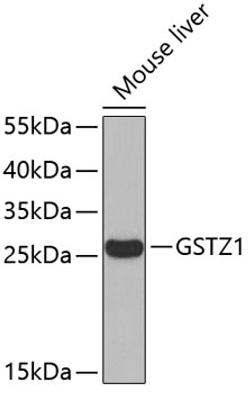 Western blot analysis of extracts of Mouse liver using GSTZ1 Polyclonal Antibody.