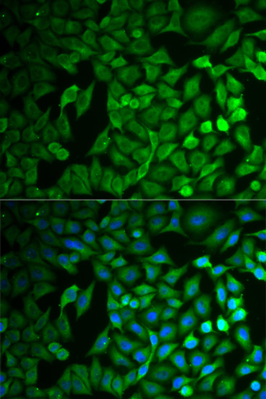 Immunofluorescence analysis of MCF-7 cells using FBXO11 Polyclonal Antibody
