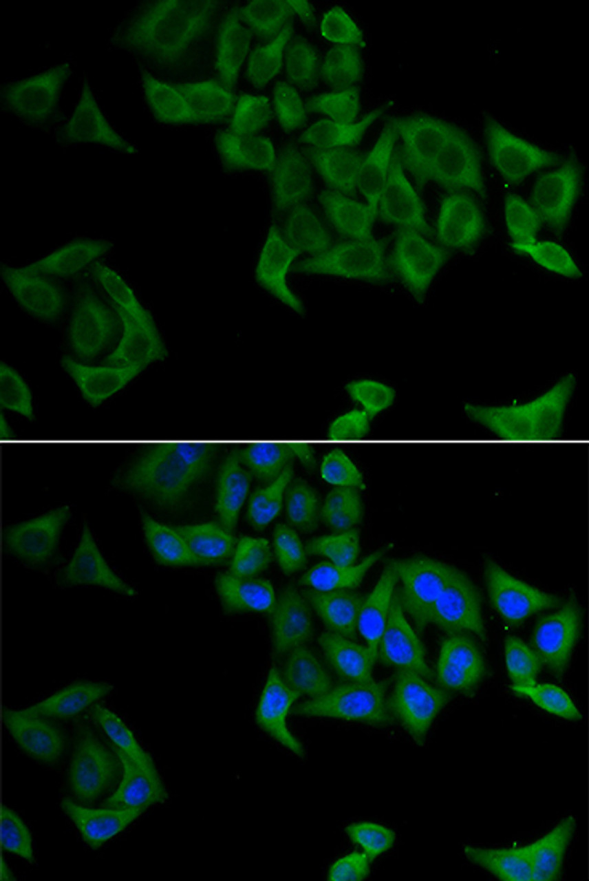 Immunofluorescence analysis of A549 cells using SMYD5 Polyclonal Antibody