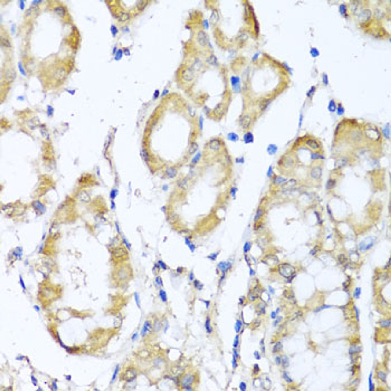 Immunohistochemistry of paraffin-embedded Human stomach using KCND2 Polyclonal Antibody at dilution of  1:100 (40x lens).