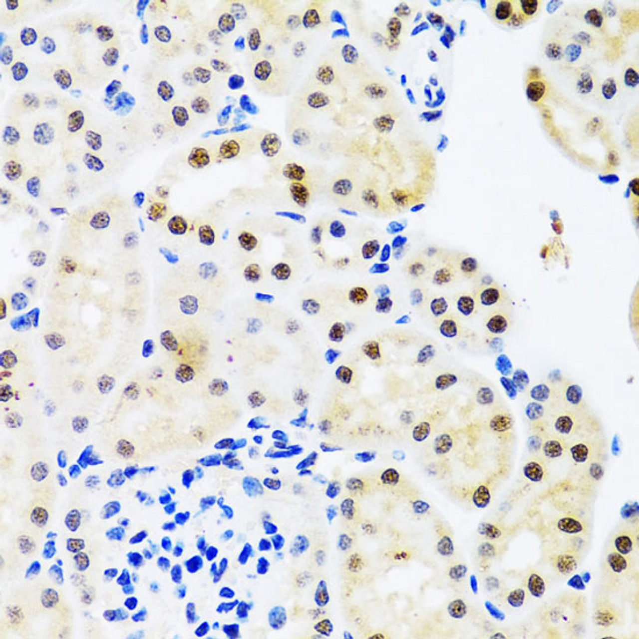 Immunohistochemistry of paraffin-embedded Mouse kidney using SET Polyclonal Antibody at dilution of  1:100 (40x lens).