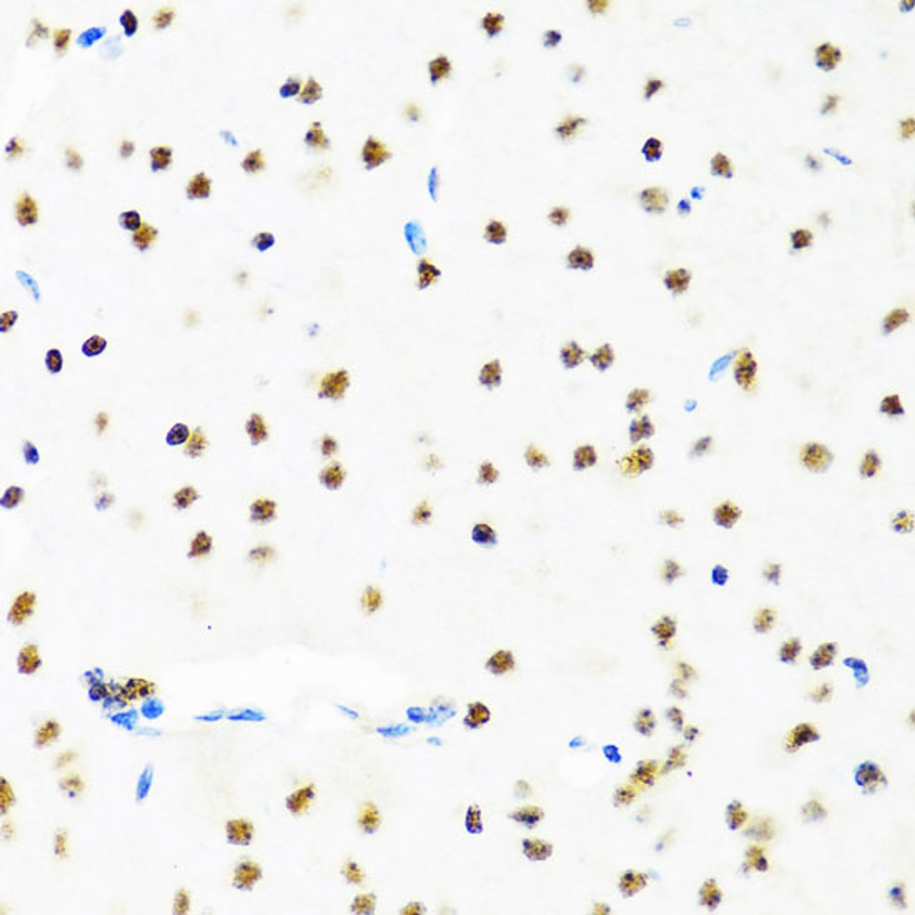 Immunohistochemistry of paraffin-embedded Mouse brain using SET Polyclonal Antibody at dilution of  1:100 (40x lens).