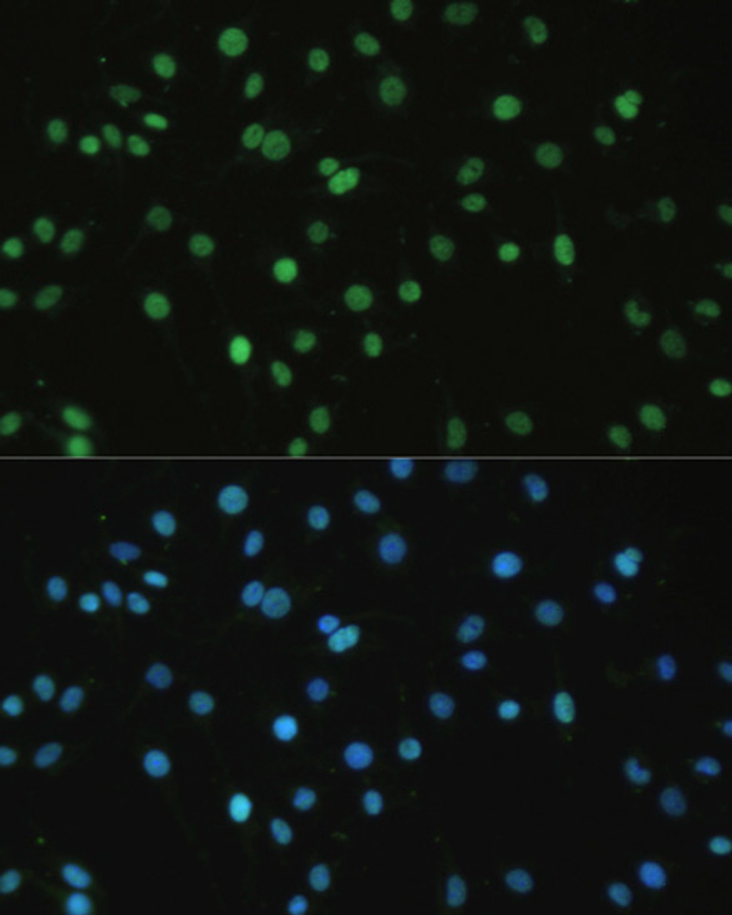 Immunofluorescence analysis of C6 cells using SET Polyclonal Antibody at dilution of  1:100. Blue: DAPI for nuclear staining.