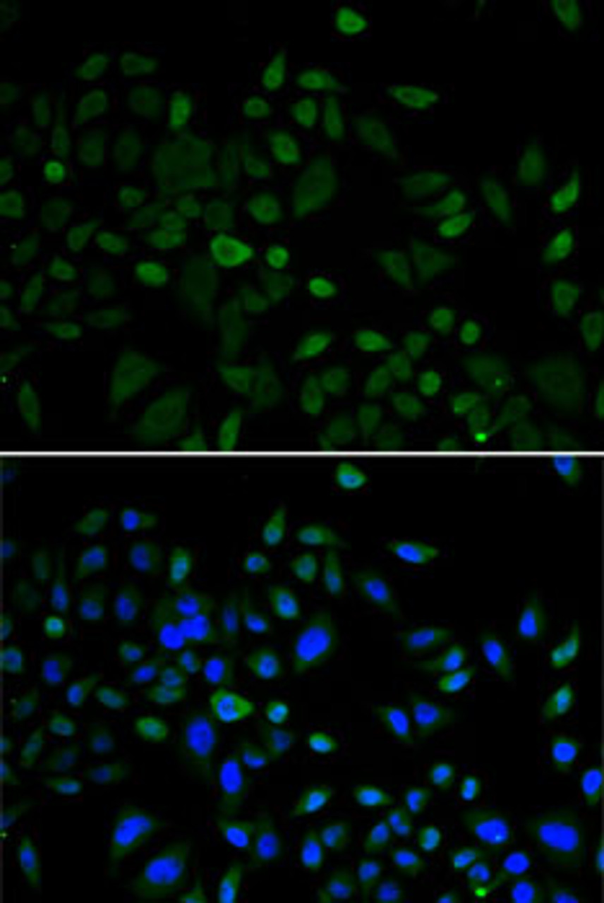 Immunofluorescence analysis of U2OS cells using CBX8 Polyclonal Antibody