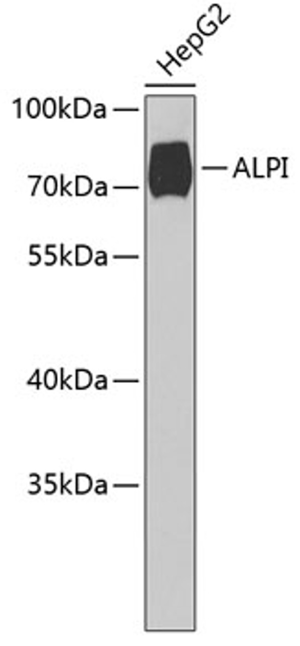 Western blot analysis of extracts of HepG2 cells using ALPI Polyclonal Antibody at dilution of 1:1000.
