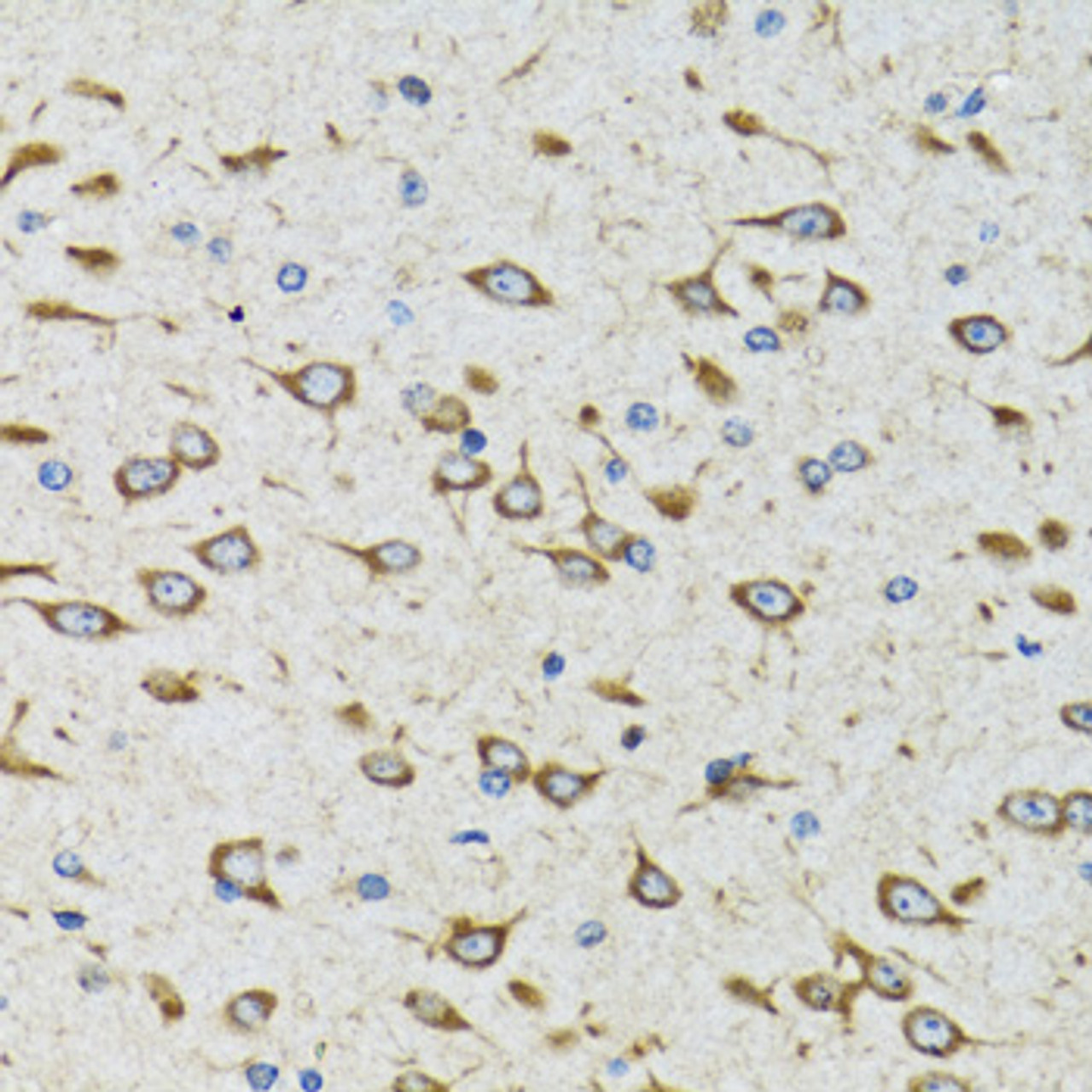 Immunohistochemistry of paraffin-embedded Rat brain using AKTIP Polyclonal Antibody at dilution of  1:100 (40x lens).