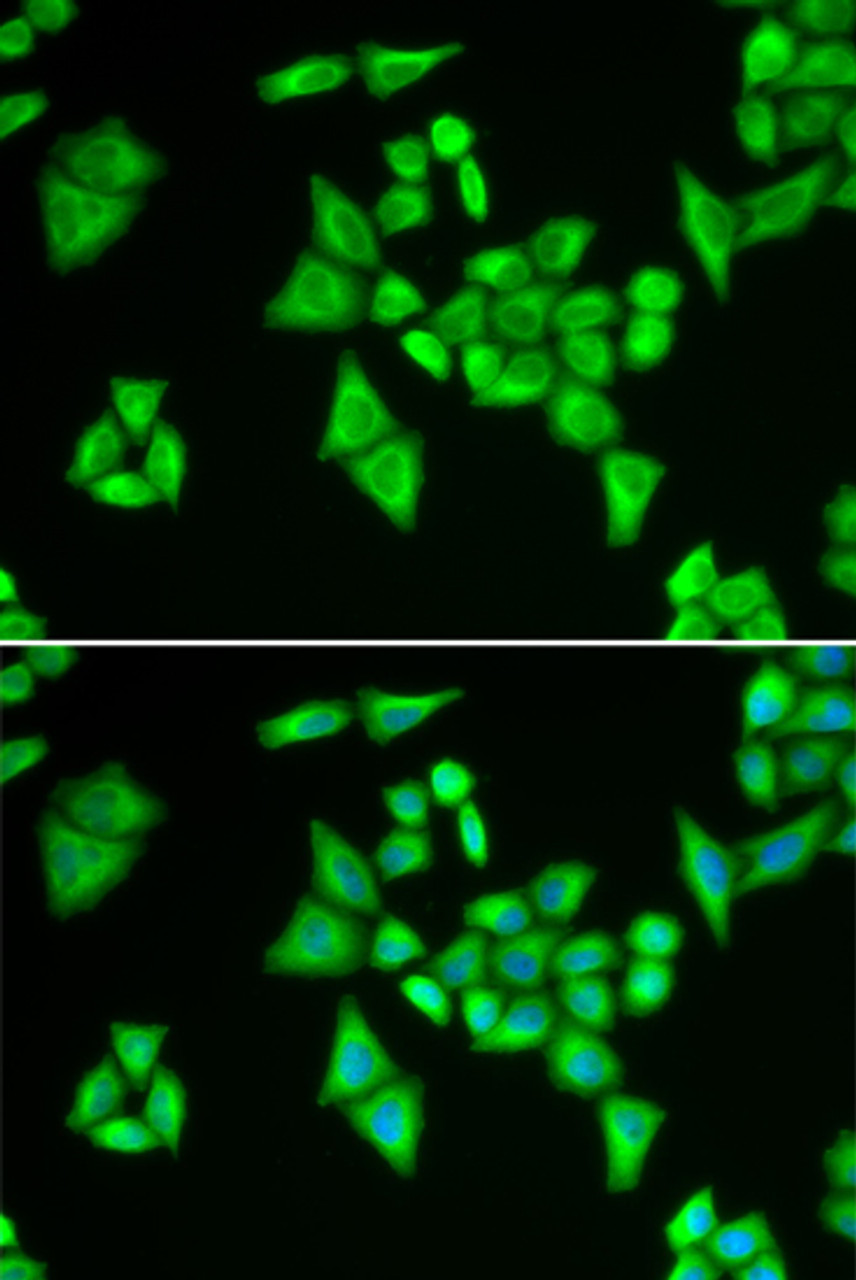 Immunofluorescence analysis of HeLa cells using ADSL Polyclonal Antibody